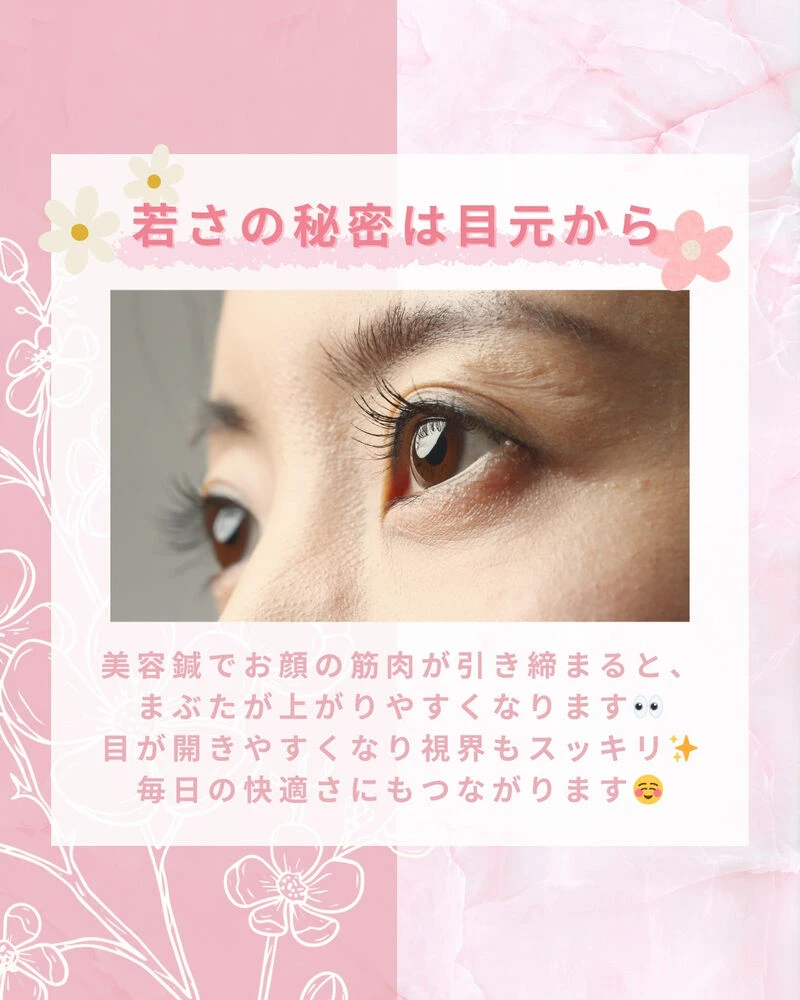 ブログ画像